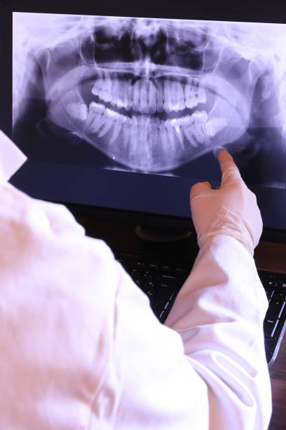 Best Emergency Treatment for Dental Infections or Abscesses in Nevada, MO