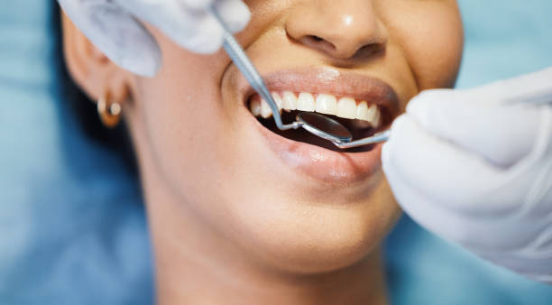 Best Emergency Wisdom Teeth Removal in Nevada, MO